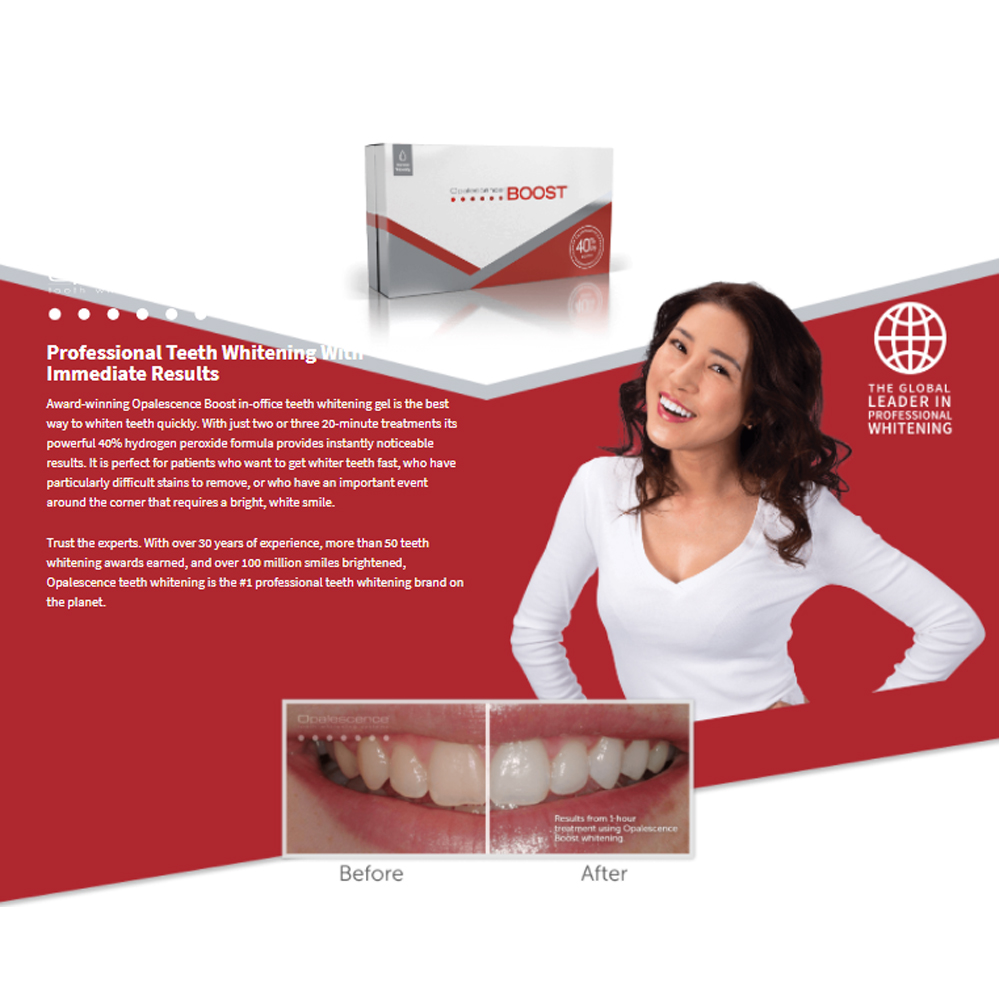 Opalescence Boost 40% PF Ameri - Teeth Whitening Opalescence ulasan dan harga