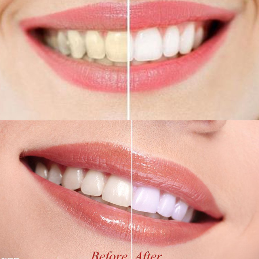 Bamboo Charcoal Teeth Tooth De - Teeth Whitening Singapore ulasan dan harga
