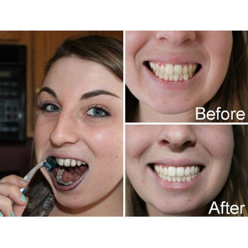Bamboo Charcoal Teeth Tooth De - Teeth Whitening Singapore ulasan dan harga
