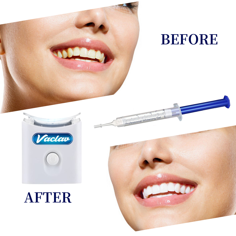 Mint Teeth Whitening Gel Syrin - Teeth Whitening Opalescence ulasan dan harga