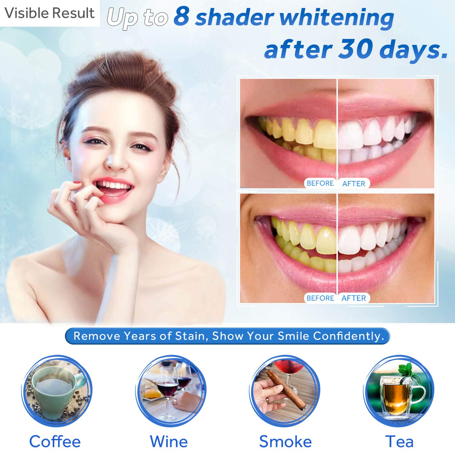 Teeth Whitening Gel Refill Syr - Teeth Whitening Opalescence ulasan dan harga