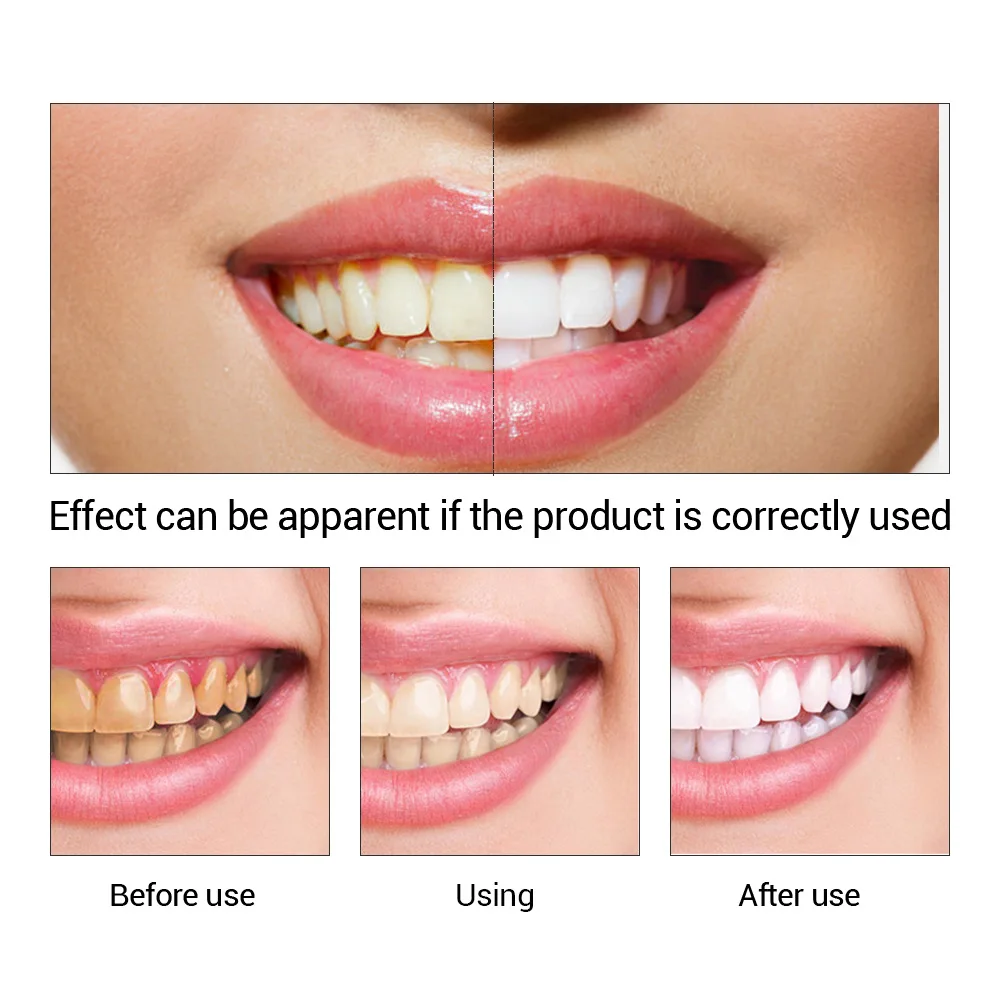 FTEENPLY Teeth Whitening Essen - Teeth Whitening Essence ulasan dan harga