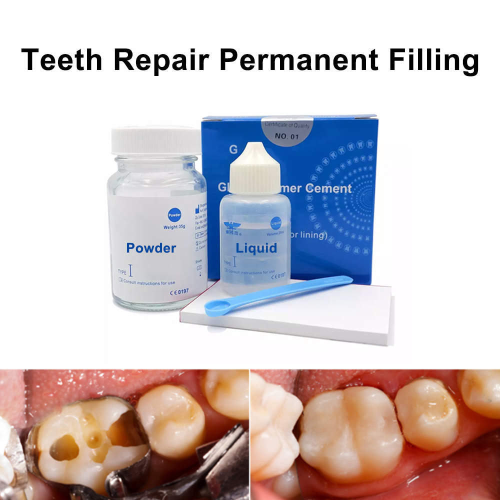 Permanent Teeth Filling Repair - Teeth Whitening Opalescence ulasan dan harga