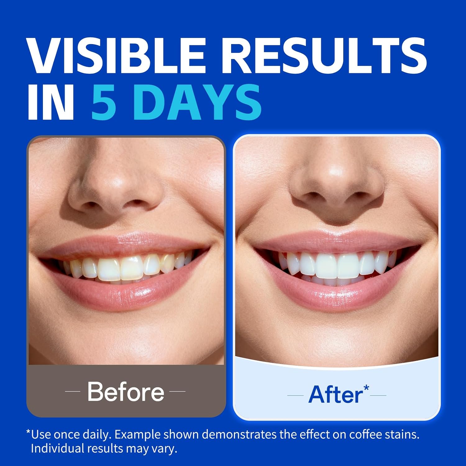 1/7 pairs Teeth Whitening Stri - Teeth Whitening Strips Crest ulasan dan harga
