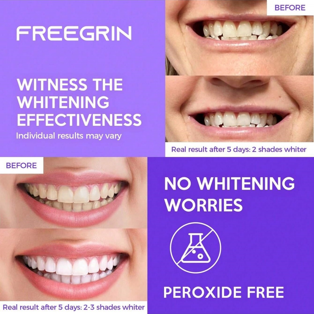 Deluxe Whitening Teeth Sticker - Teeth Whitening Singapore ulasan dan harga
